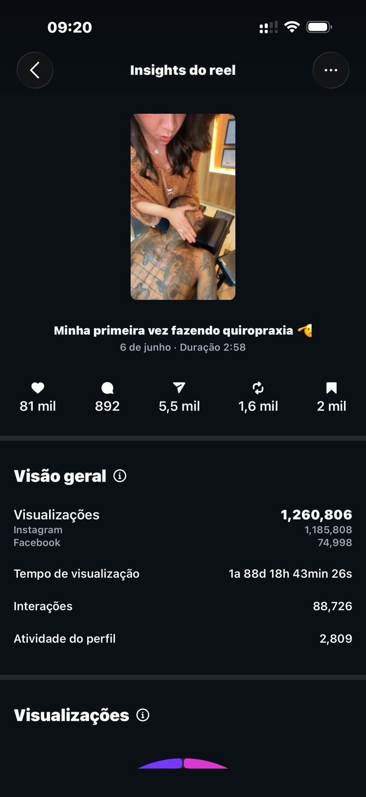 Print oficial dos insights do Reel da Fran Quiropraxia